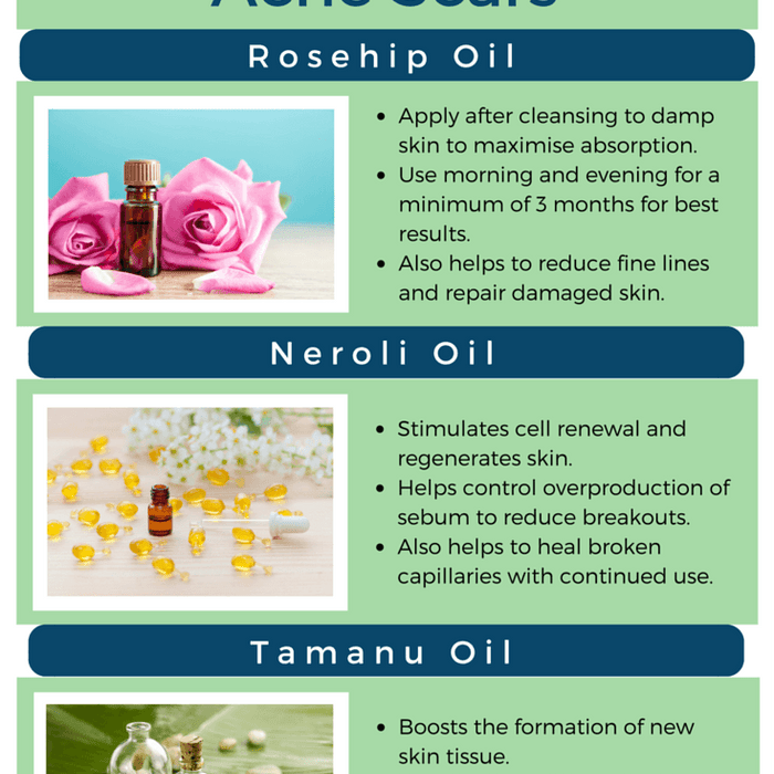 Natural Oils for Acne Scars