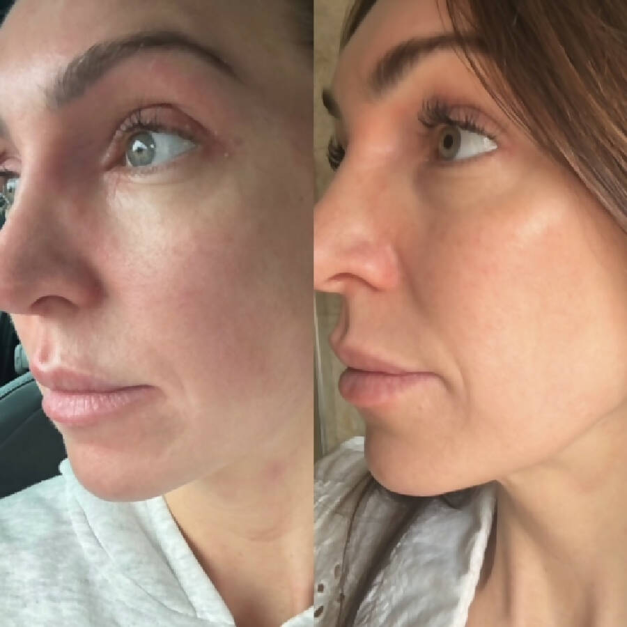 RUCI - ILLUMINATE & HYDRATE LIQUID VITAMIN SUPPLEMENT